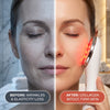 LED Light Facial Treatment Wand